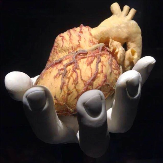 Study Reveals Insights into Dysfunction of Pig-to-Human Heart Transplant