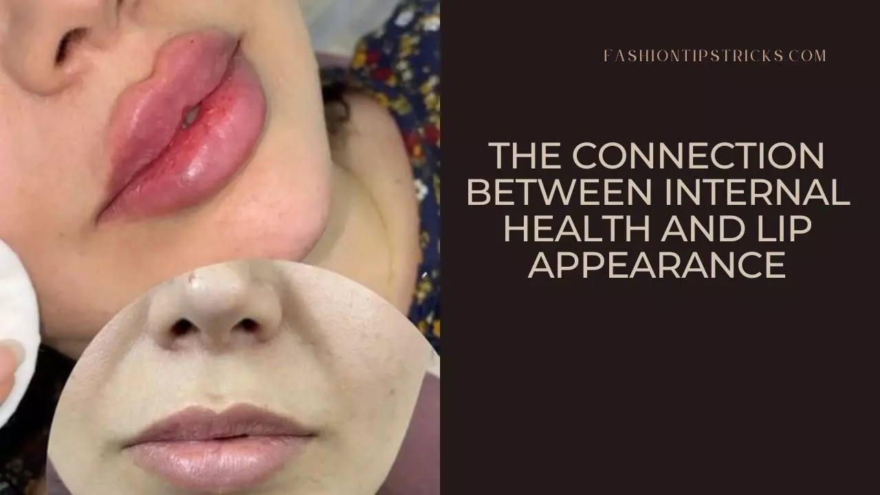 The Connection Between Internal Health and Lip Appearance