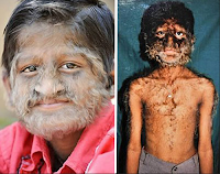 People with strange congenital malformations (14 photo)