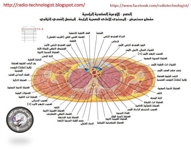 مقطع عرضى بمستوى  الفقرة الرابعة   صدرية 