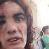 VIOLÊNCIA CONTRA MULHER - Homem que espancou mulher trans é condenado a seis meses em regime aberto