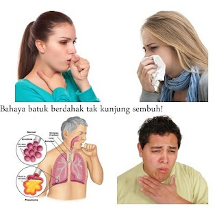 Tips Dan Cara Mengobati Batuk Di Sertai Pilek Dan Juga Flu Secara Herbal