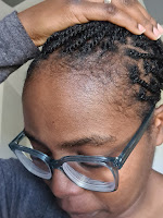 Edges missing from postpartum shedding