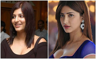 Shruti Hassan Plastic Surgery Before And After Photo