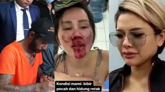 Isa Zega Menangis Dengar Pelaku Pemukulannya Orang Suruhan Nikita Mirzani