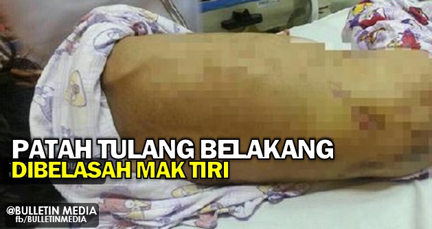 Mak Tiri Durjana!!.. Belasah Kanak-kanak 5 Tahun Hingga Patah Tulang Belakang 