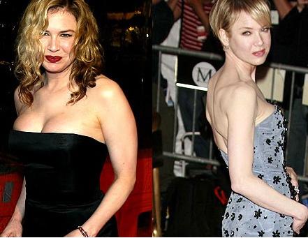 famosas antes y despues. famosas antes y despues.