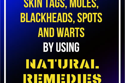  HOW TO EASILY REMOVE SKIN TAGS, MOLES, BLACKHEADS, SPOTS AND WARTS BY USING NATURAL REMEDIES