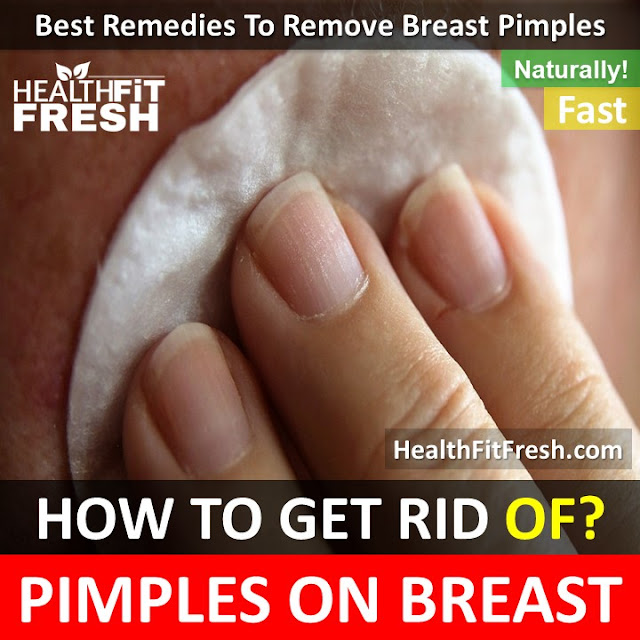 pimples on breast, how to get rid of pimples on breast, breast pimples, breast acne, breast pimples treatments, home remedies for breast pimples