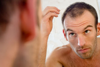 Fix Your Hair Loss Problem
