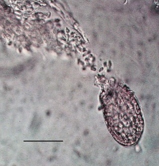 Пикниды Ampelomyces quisqualis на ястребинке ядовитой (Hieracum virosum)