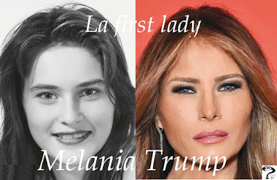 melania trum prima e dopo