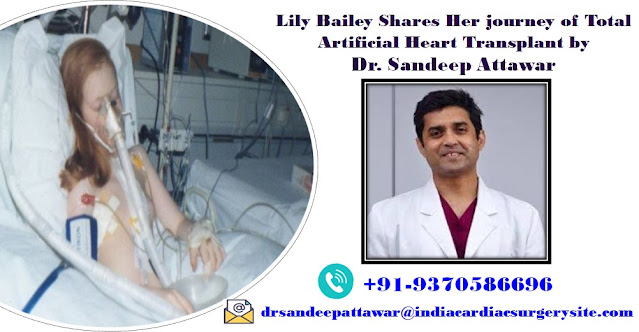 Dr Sandeep Attawar patient review