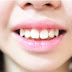 Hô hàm nhẹ có niềng răng được không? Cách nào tốt nhất?