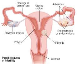 Cara Obat Sipilis