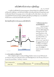   ekg คือ, ekg ผิดปกติ, ekg 12 lead ปกติ, normal sinus rhythm คือ, basic ekg, p wave คือ, การติด ekg monitor, กราฟคลื่นหัวใจผิดปกติ, ekg ย่อมาจาก