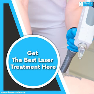 laser hair treatment