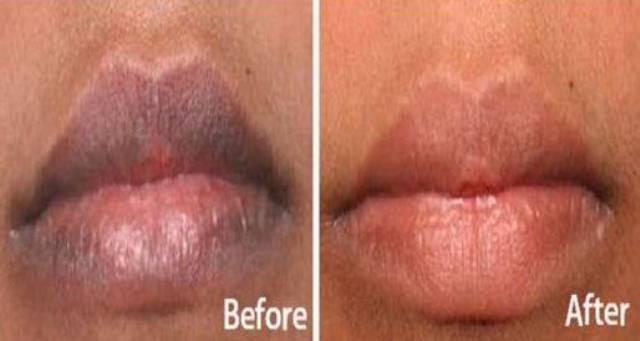 Amazing Trick to Whiten Dark Lips NATURALLY!