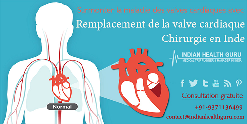 chirurgie de remplacement valvulaire à faible coût inde