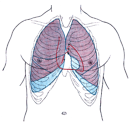 non small cell lung cancer, prognosis for stage 4 lung cancer,  what is non small cell lung cancer, chemotherapy for lung cancer, non small cell lung cancer prognosis