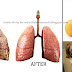 How To Purify Your Lungs Within 72 Hours!