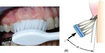 Tooth Brushing Methods | Bass & Modified Stillman Technique | Dentistry