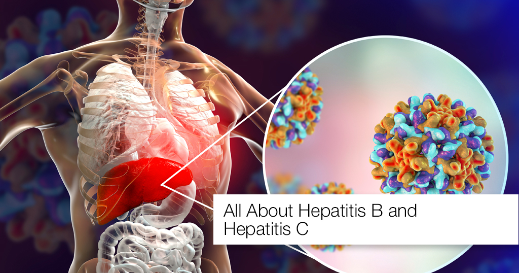 Hepatitis B or Hepatitis C
