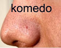 komedo