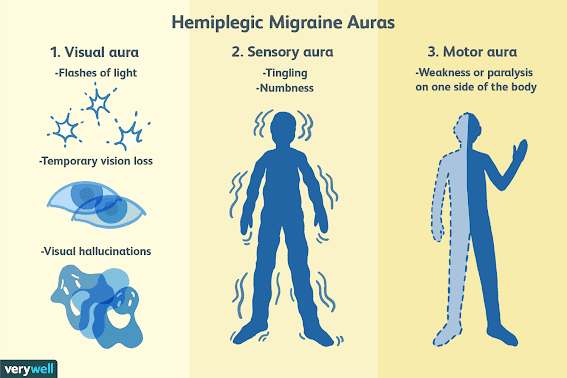 Image split into three sections. The first section on the left refers to the visual aura and illustrates some of these including flares of light, temporary vision loss and visual hallucinations. The middle section illustrates the pins and needle sensation felt. The final section on the right illustrates the one sided weakness and paralysis experienced in a hemiplegic migraine attack.