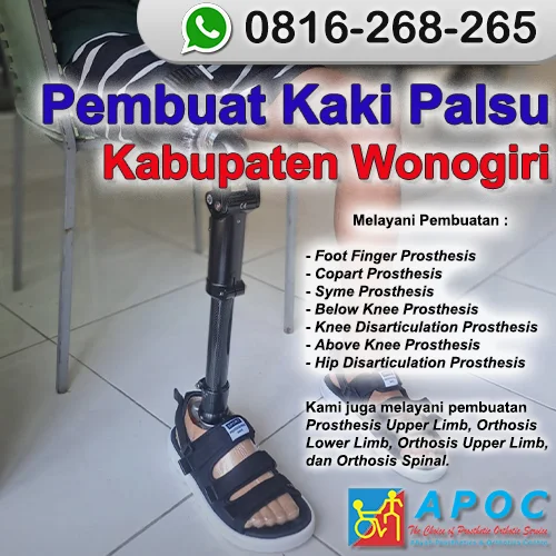 Pembuat Kaki Palsu Kabupaten Wonogiri >> WA 0816-268-265, Kaki Palsu Terpercaya