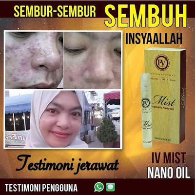 IvMist Aromatic Nano Bio Oil