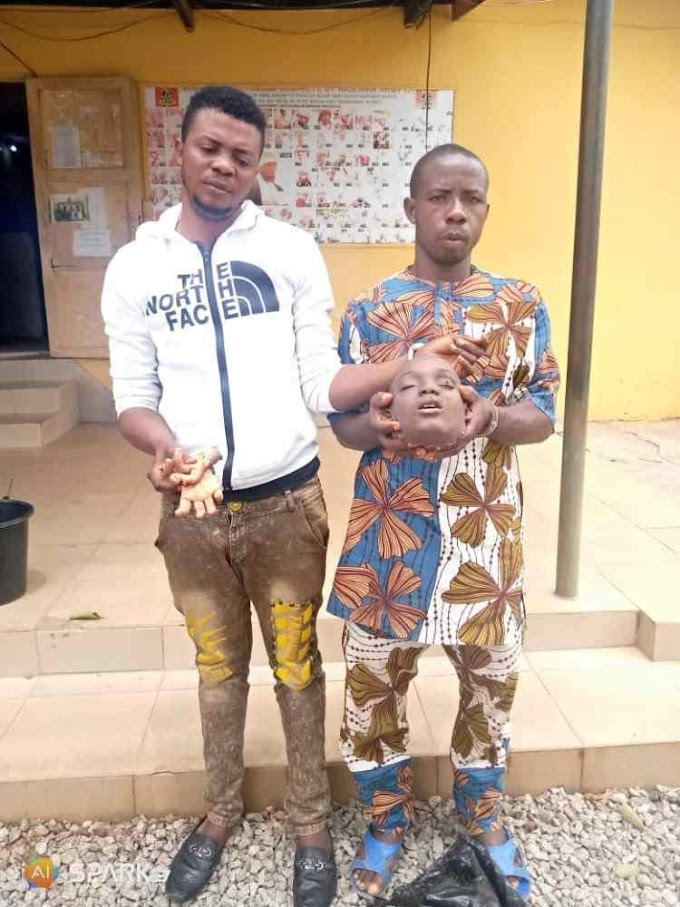 Police Nabs Two Men With Human Parts In Kwara