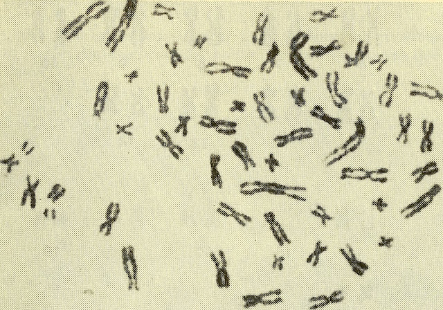 Cromosomas X curiosciencia