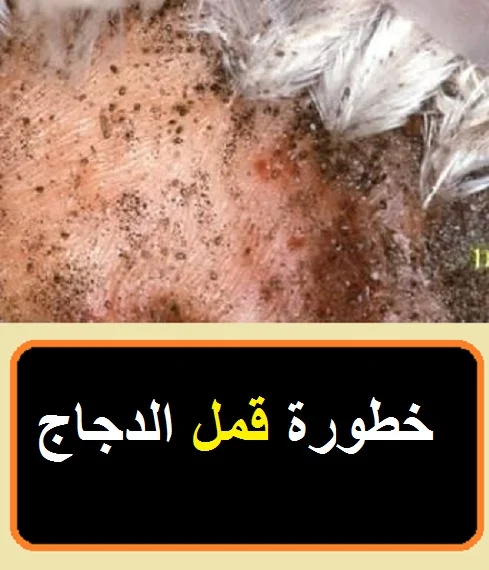 اضرار قمل الدجاج