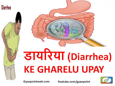  डायरिया (Diarrhea) KE 30 GHARELU UPAY IN HINDI 