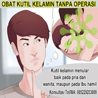 Obat Kutil Kelamin