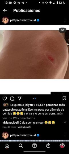 La Patricia Schwarzgruber se rompió la rodilla haciendo un bailecito estúpido para sus redes