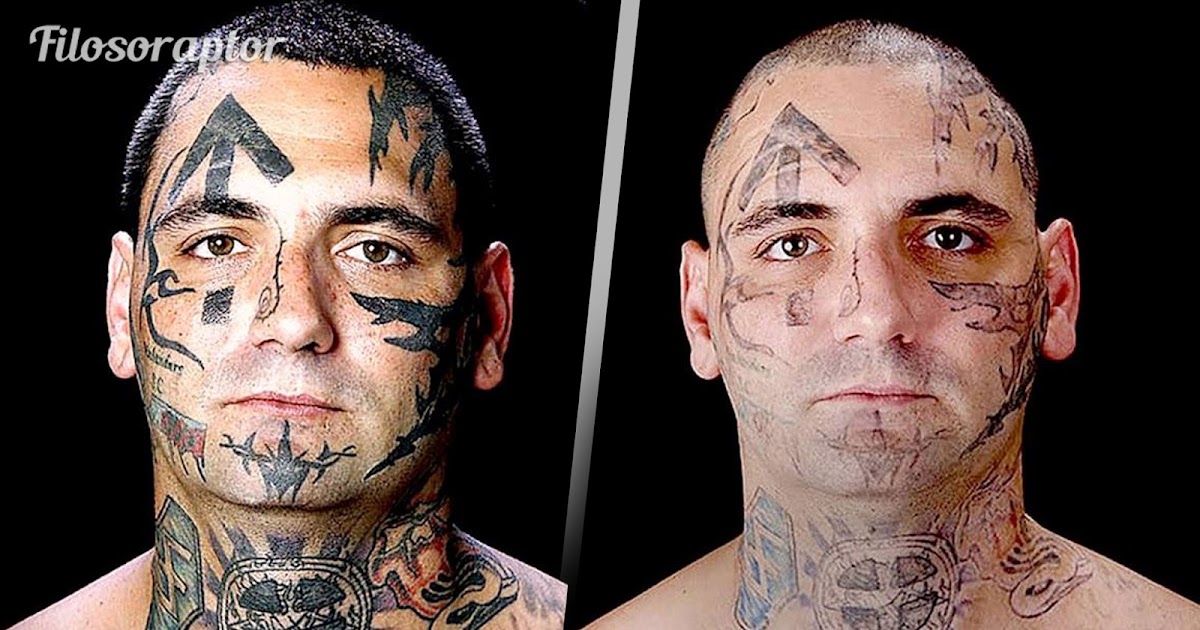 hombre ex skinhead se somete a tratamiento para borrar sus tatuajes cuando se convierte en padre