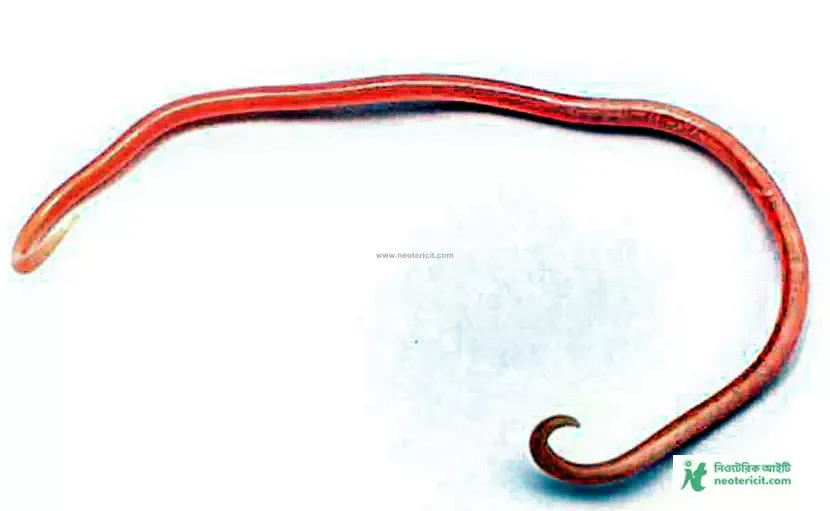 What does a worm look like Worm image - Rules for taking worm medicine - Which worm medicine is good - krimi osud khawar niyom - NeotericIT.com - Image no 1