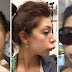 Lips Surgery Goes Wrong As Porn Star Gets XXL Lips