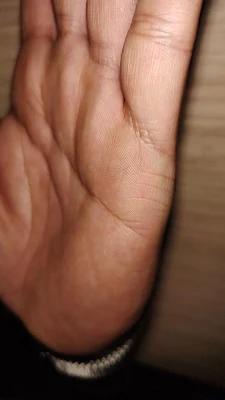 Do You Have More Than One Marriage Line On Your Hand? Parallel Marriage Lines