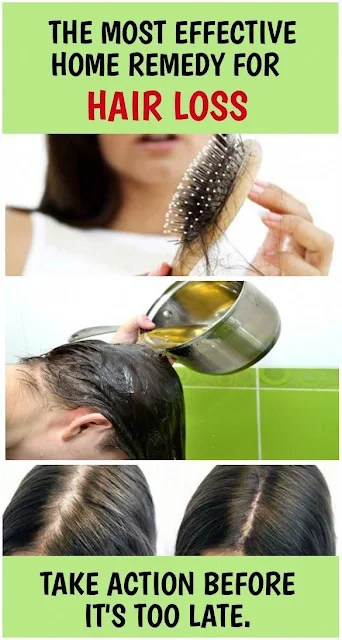 How to Prevent Hair Loss: Causes and Solutions