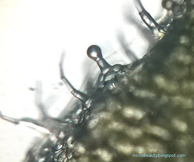 plant hairs (Plant trichomes). Magnified to 100 Times.