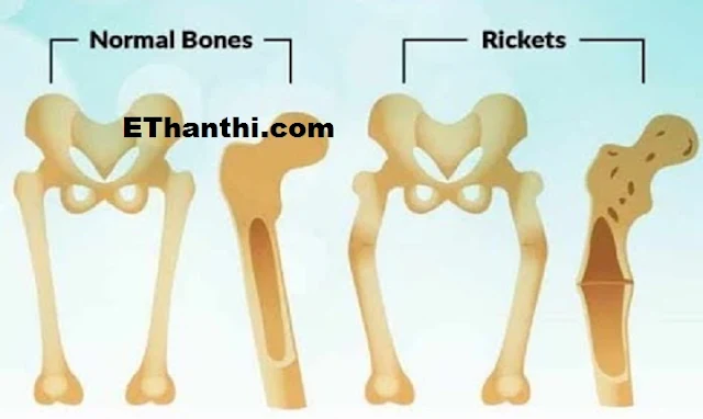 ரிக்கட்ஸ்