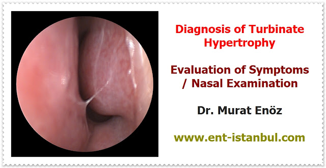 Turbinate Hypertrophy Definition - Turbinate Hypertrophy Symptoms - Causes of Turbinate Hypertrophy - Diagnosis of Turbinate Hypertrophy - Medical Treatment Options For Turbinate Hypertrophy -  Turbinate Surgery (Turbinate Resection) - Radiofrequency Turbinate Reduction - Coblation Turbinate Reduction - Radiofrequency Ablation of Hypertrophied Nasal Turbinates - Radiofrequency Turbinate Reduction in Istanbul, Turkey