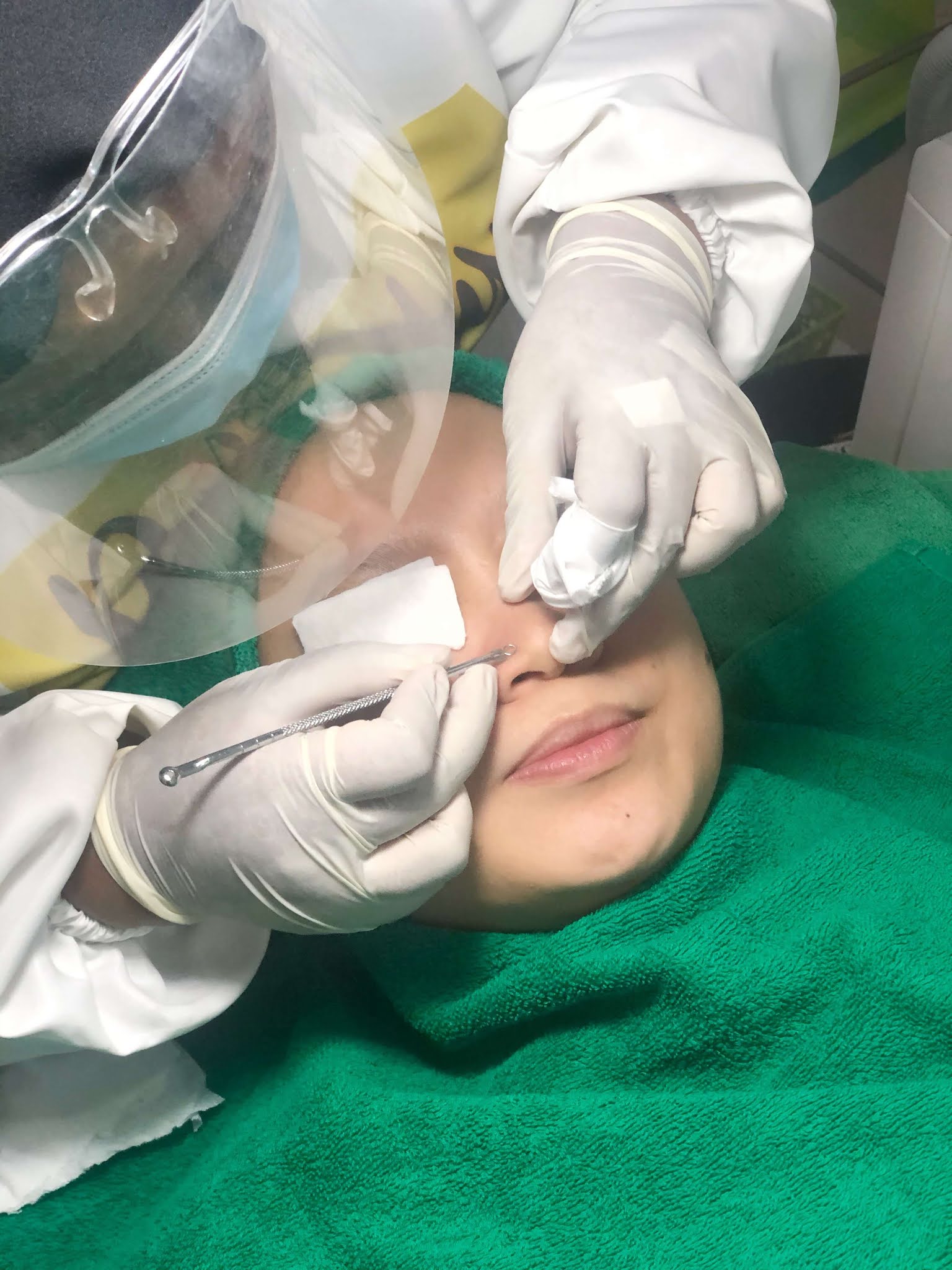 Perawatan Mesotherapy di Azqiara Klinik