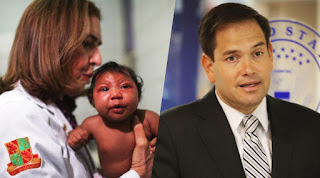 Marco Rubio Argues Against Allowing Abortions For Zika-Infected Women,Zika , Marco Rubio virus , abortion , infection,microcephaly,,Zika baby