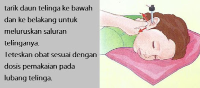 Cara Penggunaan Obat Tetes Telinga Yang Benar