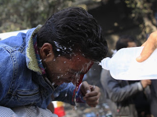 An injured Egyptian protester receives treatment