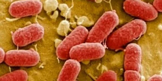 Contoh Penyakit yang Disebabkan Oleh Bakteri Lengkap Dengan Penjelasannya